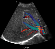 Ultrasound Example 4