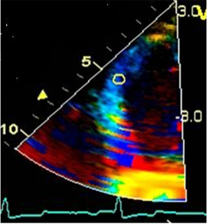 Ultrasound Example 6