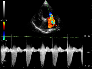 Ultrasound Example 5